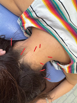 Matsudo Ekimae Central Acupuncture 사진 2