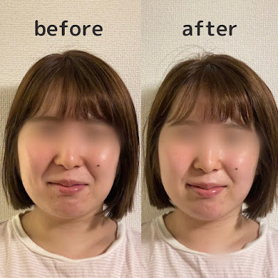 美容鍼灸整体サロンPoten 사진 4