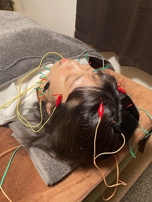 美容鍼灸整体サロンPoten 사진 5