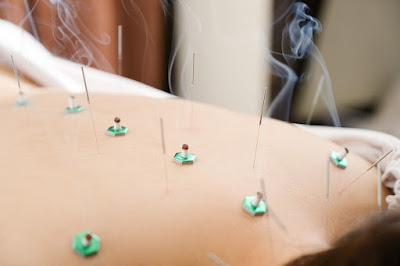 Minoridai Ekimae Acupuncture 사진 2