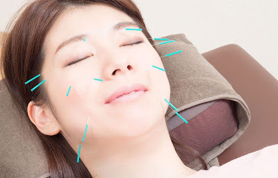 Minoridai Ekimae Acupuncture 사진 4