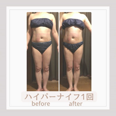 ボディケアサロン アイリフ 사진 3