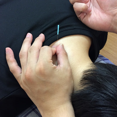 Takenotsukanishiguchi Acupuncture 사진 4