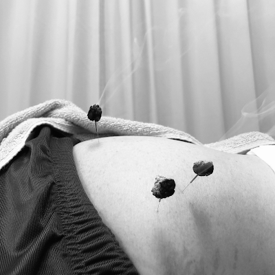 Kinniku Yotsuchiryo Personal Care Matsudoobaraharikyuin Acupuncture 사진 2