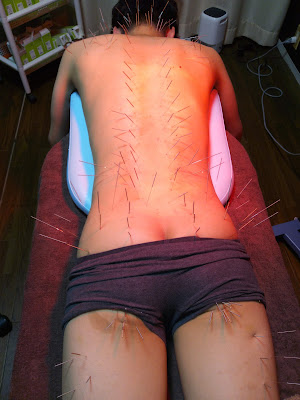 Shiraishido Acupuncture 사진 2