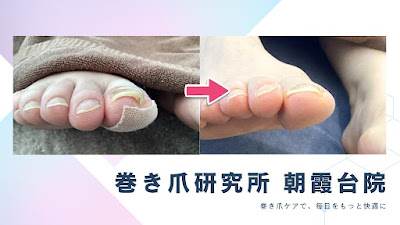 巻き爪研究所 朝霞台院 사진 3