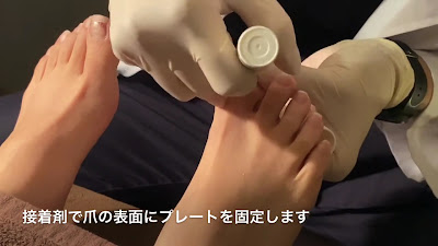 巻き爪研究所 朝霞台院 사진 2