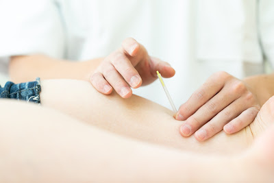 Ueno Acupuncture 사진 3