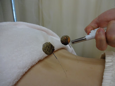 Ueno Acupuncture 사진 4
