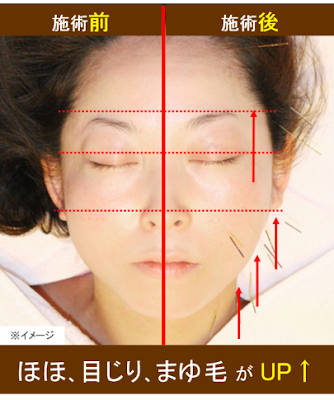 Juntendohari Kyu Massage Clinic 사진 5