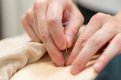 Takarashinkyu Acupuncture 사진 2