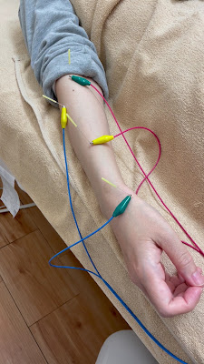 Irodorishinkyu Acupuncture 사진 2