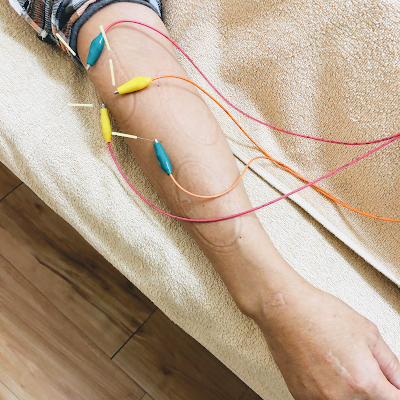 Irodorishinkyu Acupuncture 사진 4