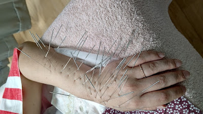 鍼灸按摩マッサージ指圧 蒲田のむすび 사진 3