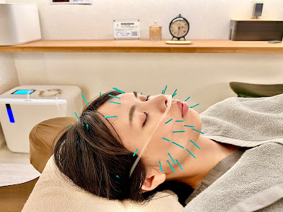 Tomarigishinkyu Acupuncture 사진 4