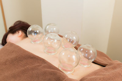 Theracua Acupuncture Clinic 사진 5