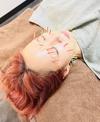 三軒茶屋美容鍼灸整体院 사진 2