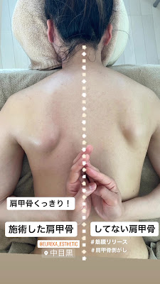 エステサロンエウレカ 사진 5