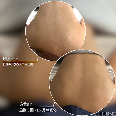 SHINONOME Facial Lab【クリスティーナ 中目黒 エステ 肌質改善 脱毛】 사진 2