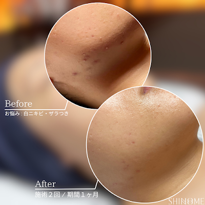 SHINONOME Facial Lab【クリスティーナ 中目黒 エステ 肌質改善 脱毛】 사진 5