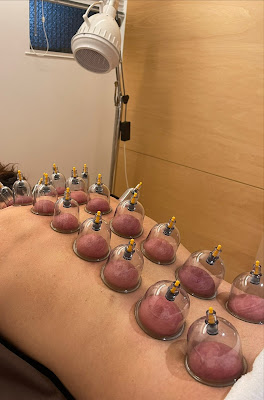 AGOSTINA Biyo Acupuncture 사진 3