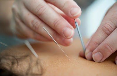 AGOSTINA Biyo Acupuncture 사진 4