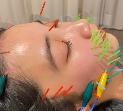 Ebisusukoyakashinkyu Acupuncture 사진 3