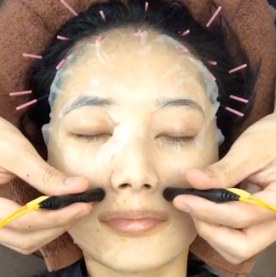 Ebisusukoyakashinkyu Acupuncture 사진 5