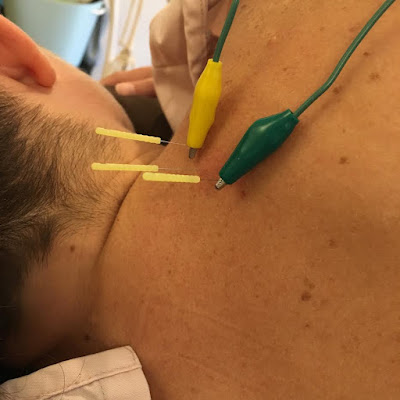 【English Available】Flow 鍼灸院｜Flow Acupuncture＆Osteopathy Tokyo | 南麻布 사진 4