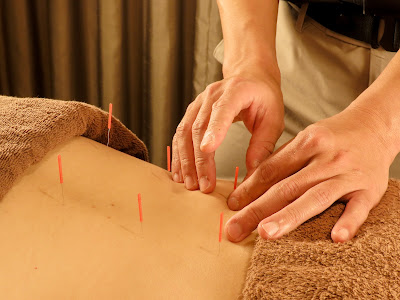 A ZAB Sabu Acupuncture 사진 4