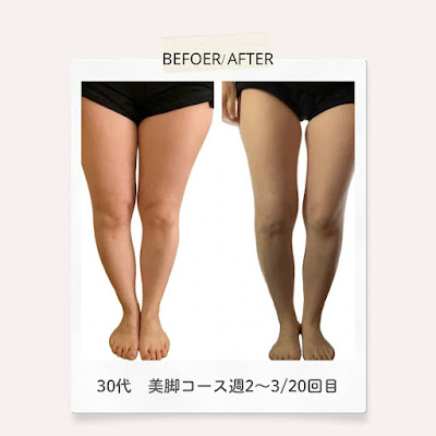 YOSAPARK Irislily 麻布十番 사진 3