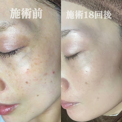 Whila(ホワラ) 南青山店 사진 5