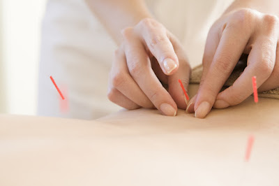 Acu-mode Acupuncture Clinic for Women 사진 4