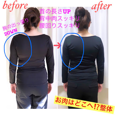 1秒整体(全身)/小顔整体p-bonheur【ピーボヌール】 사진 4