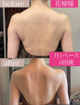 オールハンドリンパエステ eau de Lily オードリリー赤坂 사진 5