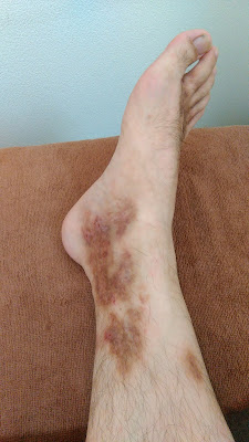 Ginzasozen Acupuncture 사진 2
