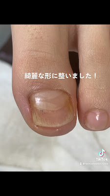 フットケアサロンランカ/銀座巻き爪矯正センター 사진 2