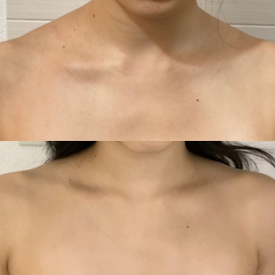 骨格美容整体bimote.新宿 사진 4