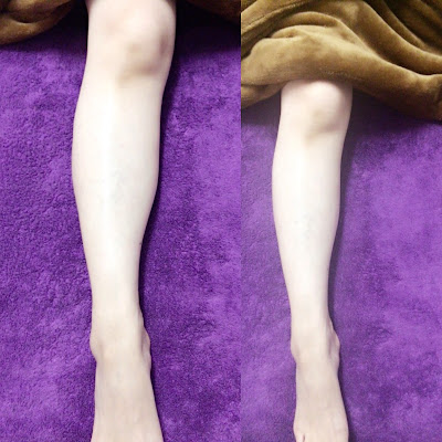 Passhon Acupuncture 사진 3