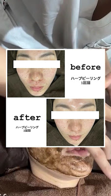 Harumi美容整体 新宿店 사진 2