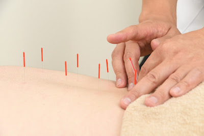 Kanda Fureaishinkyu Acupuncture 사진 4