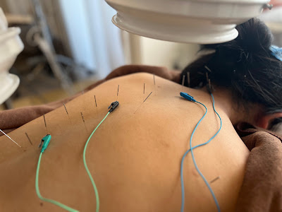 Murakami Acupuncture 사진 3