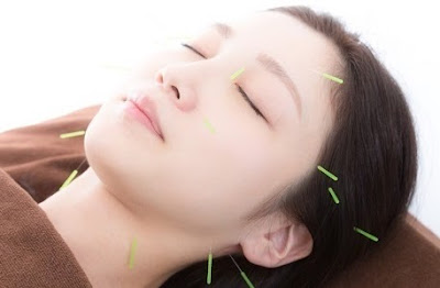 Regaro Acupuncture 사진 3