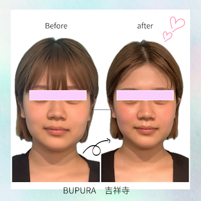 本格痩身＆小顔サロンBUPURA吉祥寺店【ブプラ】 사진 4