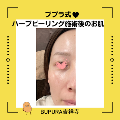 本格痩身＆小顔サロンBUPURA吉祥寺店【ブプラ】 사진 5