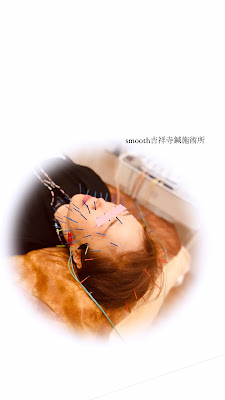 Smooth吉祥寺鍼施術所 사진 2