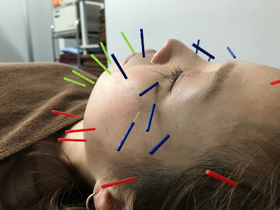 鍼灸接骨サロン〇 사진 3