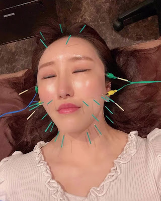 美容鍼灸サロンLOMIHARI御徒町【ロミハリ】(整体/マッサージ/美容鍼/フェイシャル/酸素カプセル/上野) 사진 2