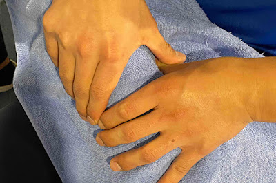 Aozoraseikotsu Acupuncture 사진 3
