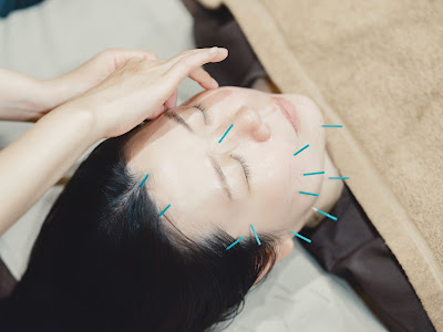 Familia Acupuncture 사진 5